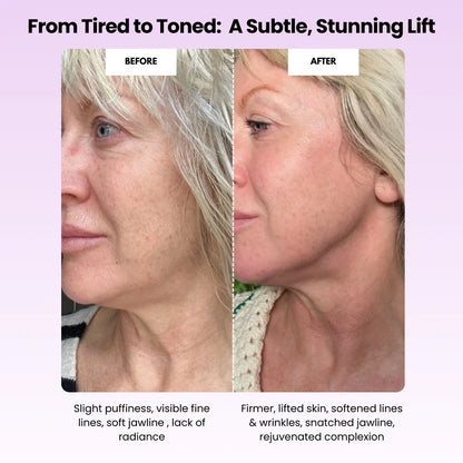 Velonia Beauty Sculptor